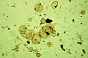 fossil pollen and spores